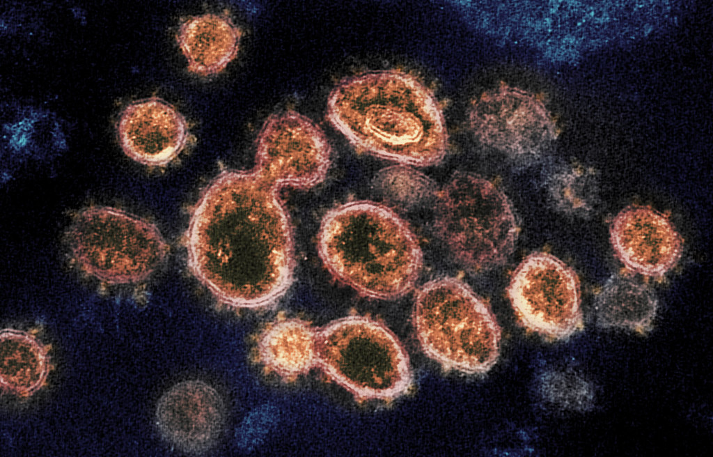 Coronavirus – Mieux vaut tard, très tard, que jamais